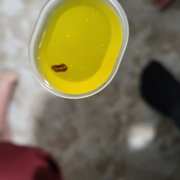 Şişede Bulunan Yabancı Parça Çocuk Sağlığını Tehdit Ediyor