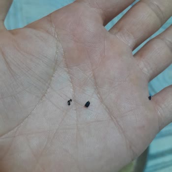 Paketli Mercimekte Taş Ve Böcek Bulunması Gıda Güvenliği İhlali