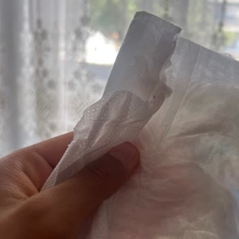 Molfix Bebek Bezinde Cırt Cırt Bölgesinde Yapışkan Madde Sorunu