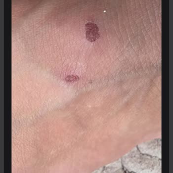 Ataköy Ayakkabı Ayağımda Ciddi Acı Ve Yaralar Oluştu