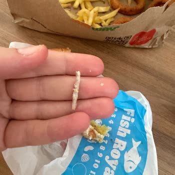Big King’de Kemik Parçası Diş Ağrısına Neden Oldu