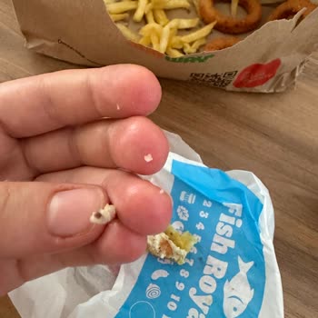 Big King’de Kemik Parçası Diş Ağrısına Neden Oldu