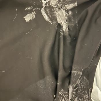 Yapışkan Göğüs Pedi Alerjik Reaksiyon Ve Müşteri Hizmetlerinden Cevapsızlık