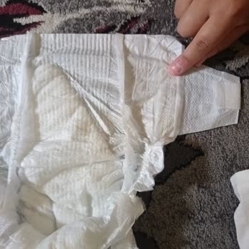 Molfix Bebek Bezinde Pamuk Eksikliği Kullanılamaz Duruma Yol Açtı