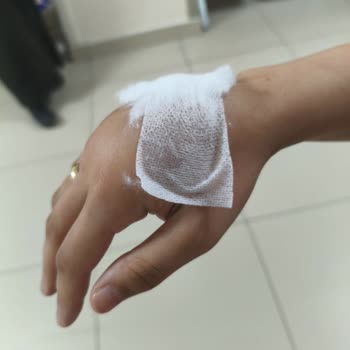 Serumun Yanlış Uygulaması Ve Şiddetli Şişlik, Hastane Personelinin Ciddiyetsiz Yaklaşımı