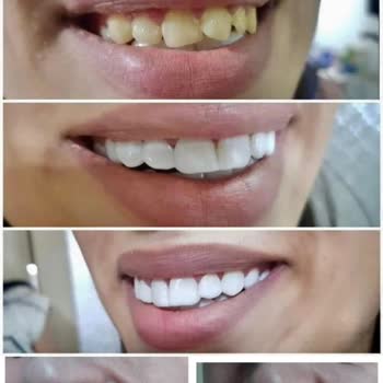 Ser Grup Depolama Reklam Gelen Ürün, Reklamda Gösterilenle Hiçbir Şekilde Örtüşmüyor