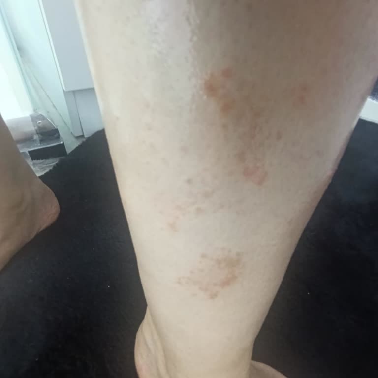 Yalova Essayer Güzellik Merkezi Verilen Sözler Tutulmadı