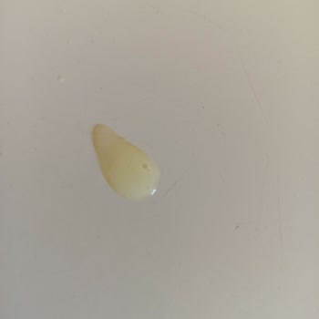 Purest Solutions Serumu Değişikliği Sonrası Sivilcelenme Ve Cevapsız Müşteri Desteği