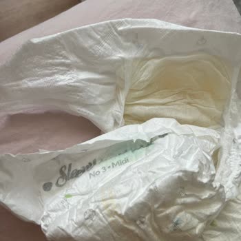 Islaklık Göstergesi Çalışmıyor, Bebekte Pişik Yaşandı