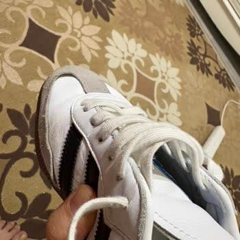 Adidas Spor Ayakkabısının 2 Aylık Kullanım Sonrası Ön Kısmının Açılması Ve Garanti İadesi Talebi