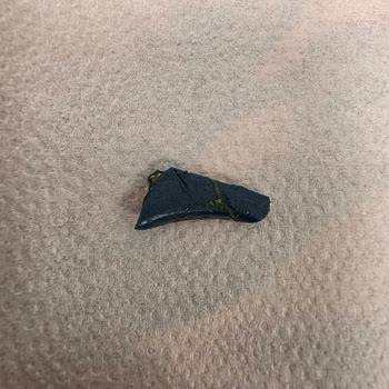 Nimet Böreğinde Plastik Parça: Diş Kırılma Riski Ve Açıklama Talebi