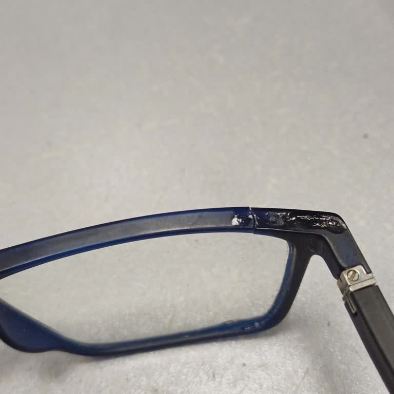 Lee Cooper Gözlüğünün Çerçevesi Kırıldı Ve Elif Optik Cevap Vermedi
