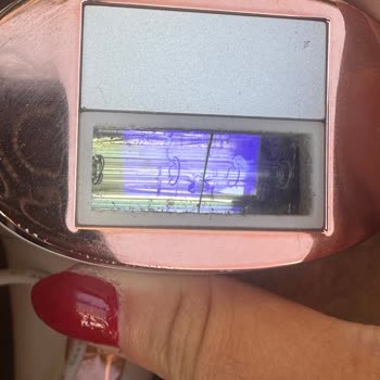 Garantili IPL Cihazım Çatladı, Şirket Destek Vermiyor