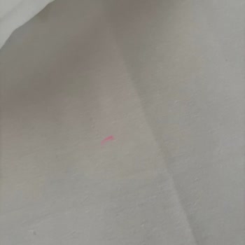Oda Ve Restoran Hijyeni Ciddiyetle İhmal Edilmiş