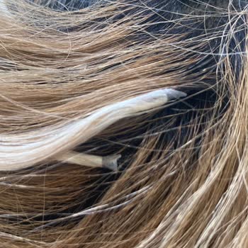 Kalitesiz Keratin Kaynak İşlemi Sonrası Aşırı Kaşıntı Ve Saç Dökülmesi