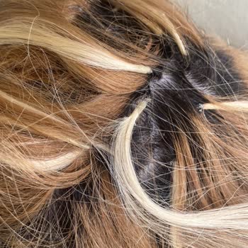 Kalitesiz Keratin Kaynak İşlemi Sonrası Aşırı Kaşıntı Ve Saç Dökülmesi
