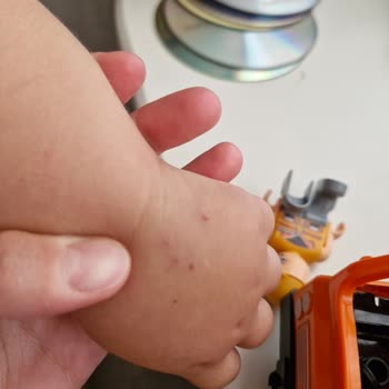 Deneyimsiz Personelin Çocuğuma Sekiz Kez Damar Yolu Açması
