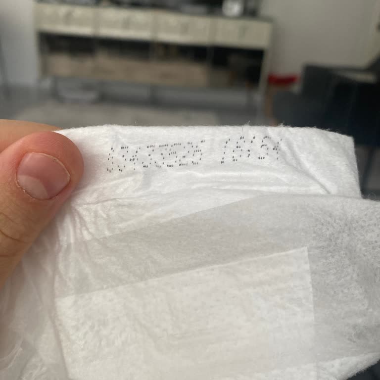 Molfix Natürel Bebek Bezinde Sürekli Sızdırma Ve Pişik Sorunu