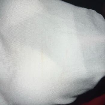 Lekeli Ürün Satışı Ve İade Reddiyle Mağdur Oldum
