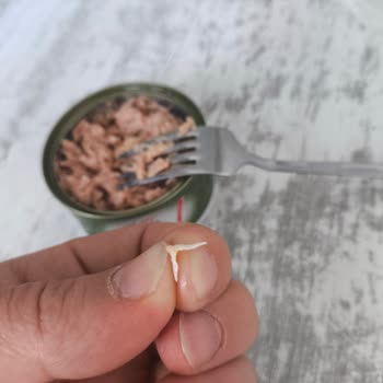 Tonla Ton Balığında Yabancı Cisim: Çocuğumun Sağlığına Tehdit