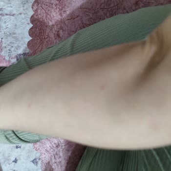 A101 Bozüyük Şubesinde Bozulmuş Dondurulmuş Dana Köfte Satışı Halk Sağlığını Tehlikeye Attı