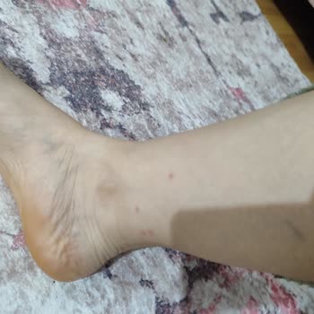 A101 Bozüyük Şubesinde Bozulmuş Dondurulmuş Dana Köfte Satışı Halk Sağlığını Tehlikeye Attı