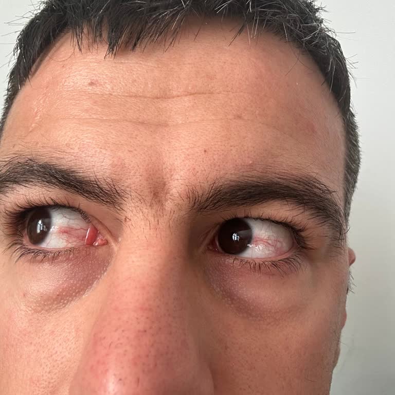 Ameliyattan Sonra Göz Rahatsızlığı Ve Haksız 600 TL Muayene Ücreti
