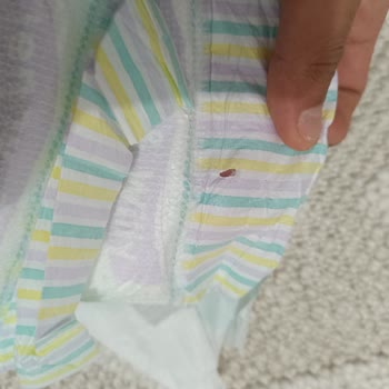 Jenny & Willy Bebek Bezlerinde İğnelenmiş Ürün Ve Güvenlik Sorunu