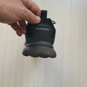 Topuk Çökmesi Ve Garanti Sürecinde Şeffaflık Bekliyorum