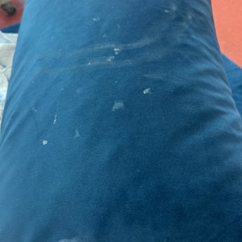 Hijyenik Olmayan Refakatçi Koltukları Ve Saygısız Personel Tutumu