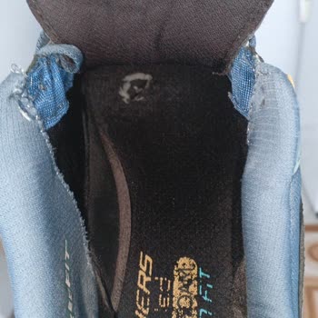 İki Ayda Yırtılan Skechers Ayakkabıya Kullanıcı Hatası İddiası Ve İade Talebi