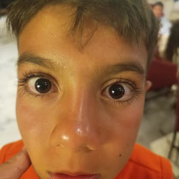 Hijyen Ve Güvenlik İhmaliyle Mahvolan Konaklama