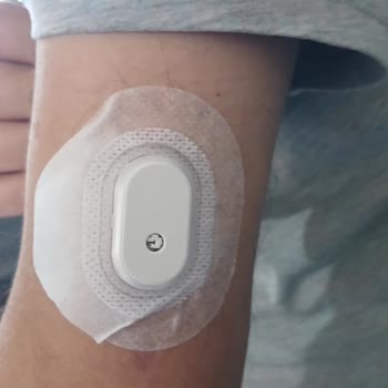 Defolu Glukoz Sensörleri Nedeniyle Ağrı Okunamayan Ölçüm Ve Tam İade Talebi