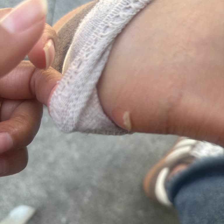 İlk Kullanımda Ayakkabım Ayağımı Yara Yaptı; İade Talebim Var