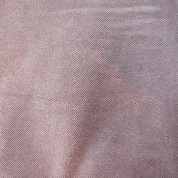 H&M Şortunun Kısa Sürede Renk Atması Ve Kalite Sorunu