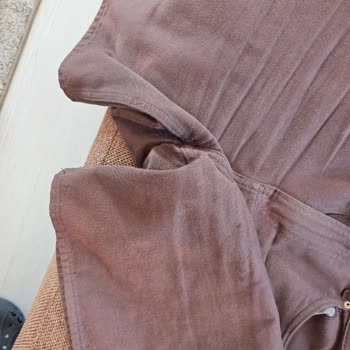 H&M Şortunun Kısa Sürede Renk Atması Ve Kalite Sorunu