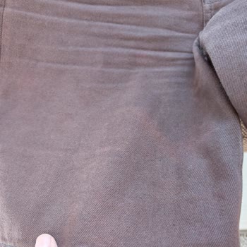 H&M Şortunun Kısa Sürede Renk Atması Ve Kalite Sorunu