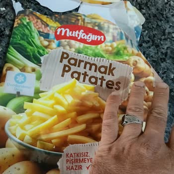BİM Şubesinde Dondurulmuş Patates Ürünün İçinde Böcek