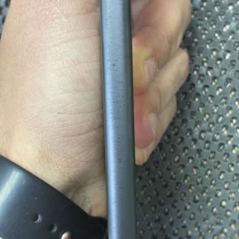 Titanyum Kasa Çizildi, Cihaz Performans Ve Isınma Sorunları Yaşıyor, Servis Sorun Yok Diyor