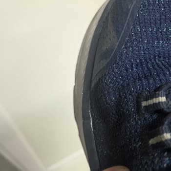 Skechers Ayakkabısının Garanti Reddi Ve Kalite Sorunu