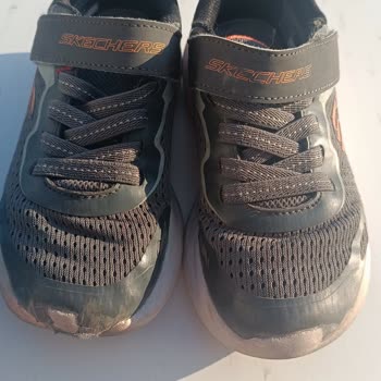 Üç Ayda Skechers Çocuk Ayakkabısının Kauçuk Parçalanması Üretim Hatası Olarak Değerlendirilmeli
