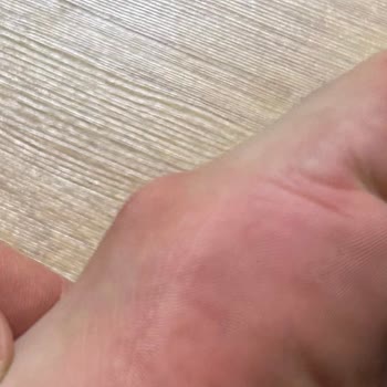Kalıcı Ayak Ağrısı Ve Deformasyon Yaratan Puma Ayakkabı İçin İade Talebi