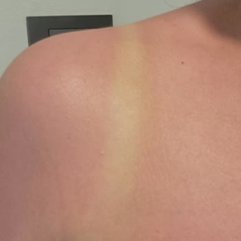 Nivea Sun Kids Crema Solar Quemó Mi Piel, No Proporcionó Protección