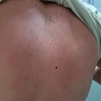 Nivea Sun Kids Crema Solar Quemó Mi Piel, No Proporcionó Protección