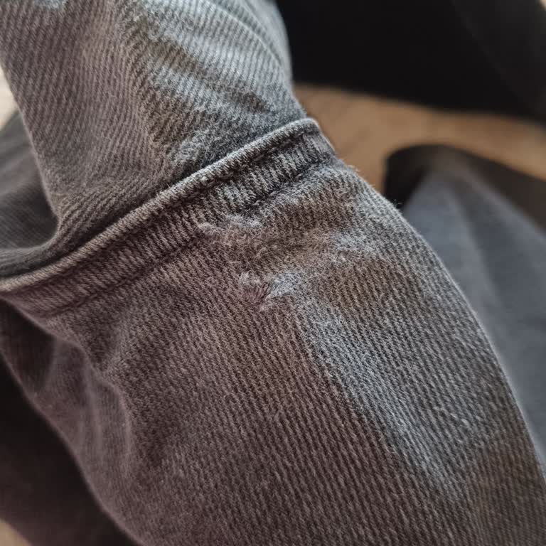 Pantolon Açılması Ve Kullanıcı Hatası Gerekçesiyle Reddedilme