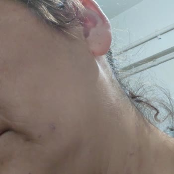 Kredi Kartı Tek Çekim, Taksitlendirme İptali Ve Fiziksel Şiddet