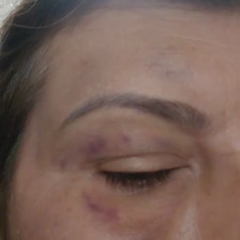 Kredi Kartı Tek Çekim, Taksitlendirme İptali Ve Fiziksel Şiddet