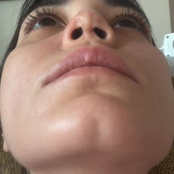 Eki aç