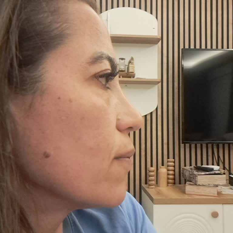 Rinoplasti Sonrası Yaşadığım Simetri Bozukluğu ve Nefes Alma Sorunları