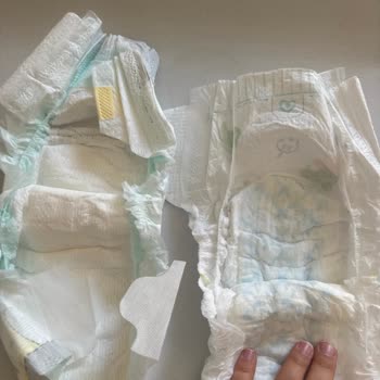 Trendyol'dan Gelen Prima Bebek Bezlerinde Kalitesiz Ve Sızdırma Sorunu